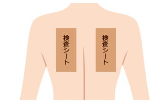 パッチテスト